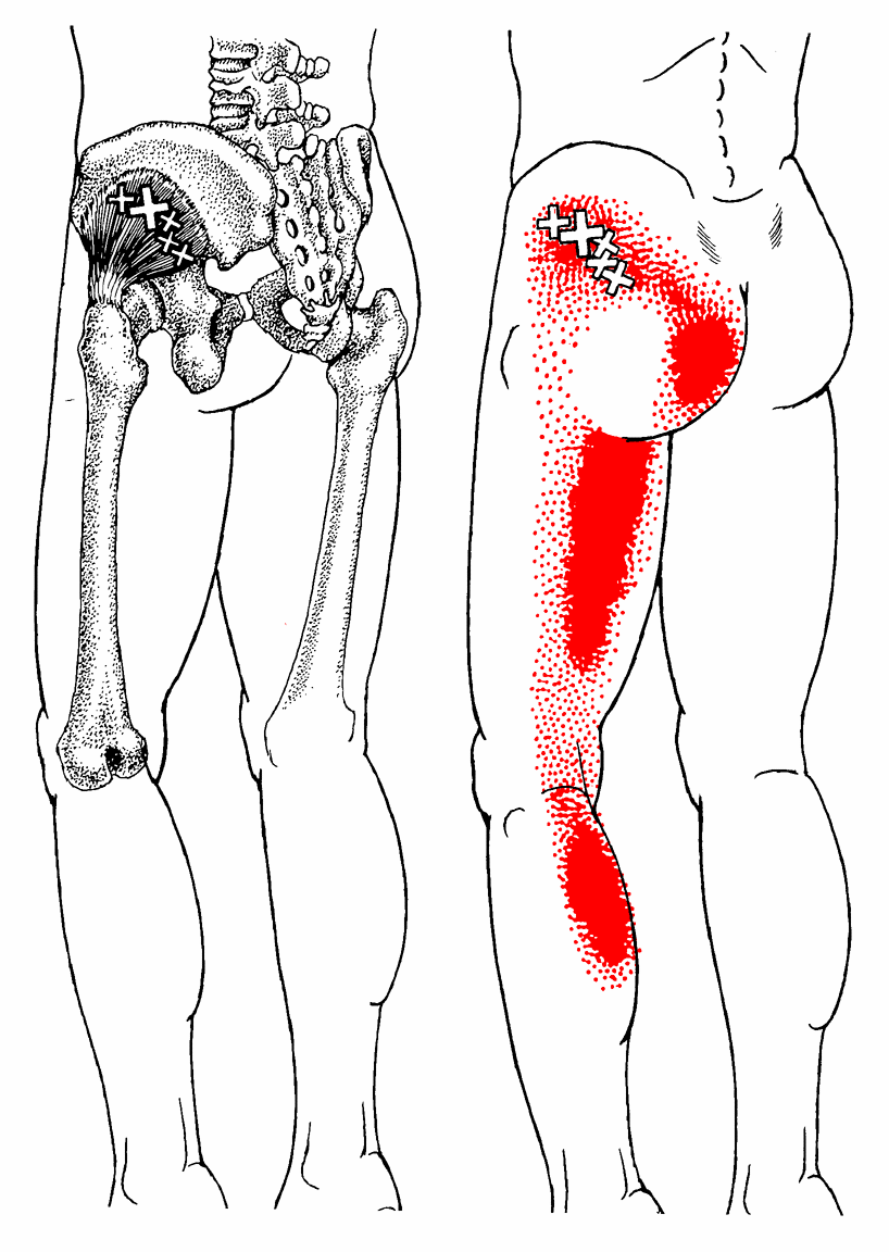 Hip Flexor Stretches To Relieve Tight Hips Gluteus Minimus Trigger